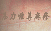 皮肤划痕症