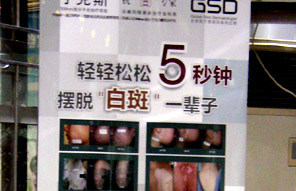轻轻松松5秒钟摆脱白斑一辈子