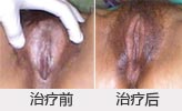 ͼƬ....